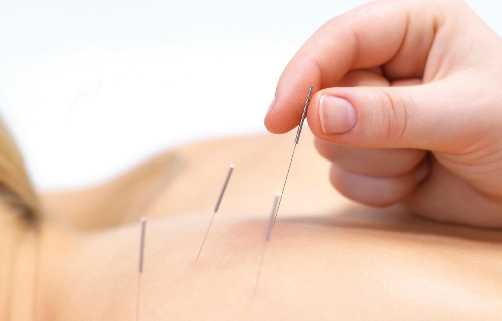 Ackerman Acupuncture & Massage, Blaine, Minnesota