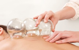 Our Services: Cupping - therapeutic, sport, & pain management acupuncture in Minnesota