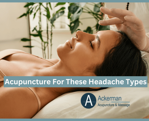 Acupuncture For These Headache Types - Ackerman Acupuncture