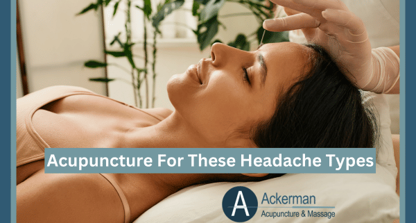 Acupuncture For These Headache Types - Ackerman Acupuncture