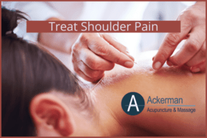 Treat Shoulder Pain- Woman Receiving Acupuncture to the shoulder area