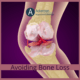 Preventing Bone Loss - Ackerman Acupuncture