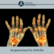 Acupuncture For Arthritis