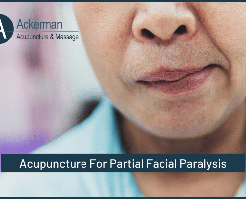 Acupuncture For Partial Facial Paralysis- Ackerman Acupuncture
