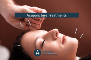 Acupuncture Treatments