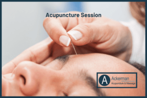 Acupuncture Session