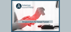 Acupuncture for Carpal Tunnel- Ackerman Acupuncture and Massage
