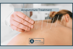 Acupuncture Treatment- Insurance Coverage